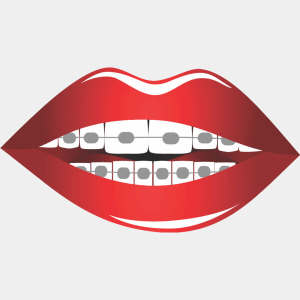 Lips Braces 2 Thumbnail